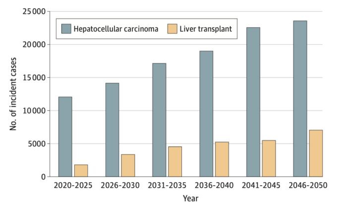 Figure 4. Model Prediction of Annual Incident Metabolic Dysfunction–Associated Steatotic Liver Disease–Related Hepatocellular Carcinoma and Liver Transplant Between 2020 and 2050